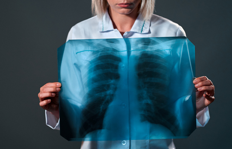 diagnostico e tratamento da pneumocistose