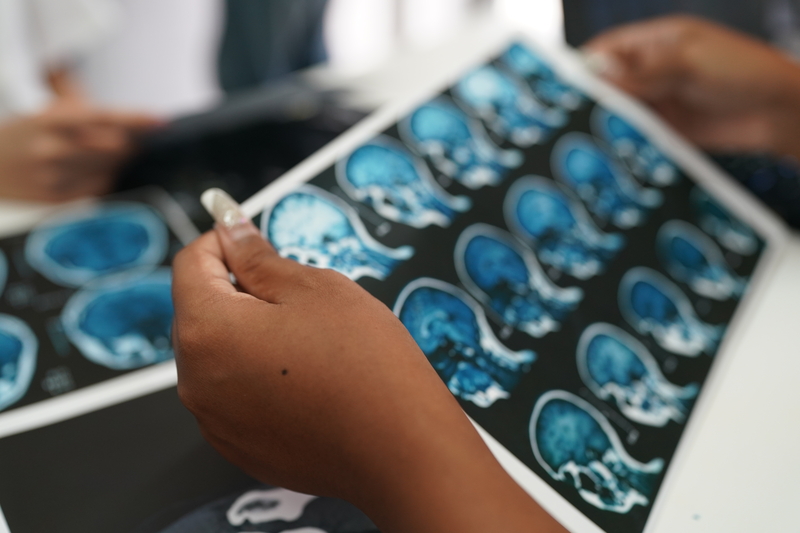 como ocorrem as sindromes neurologicas