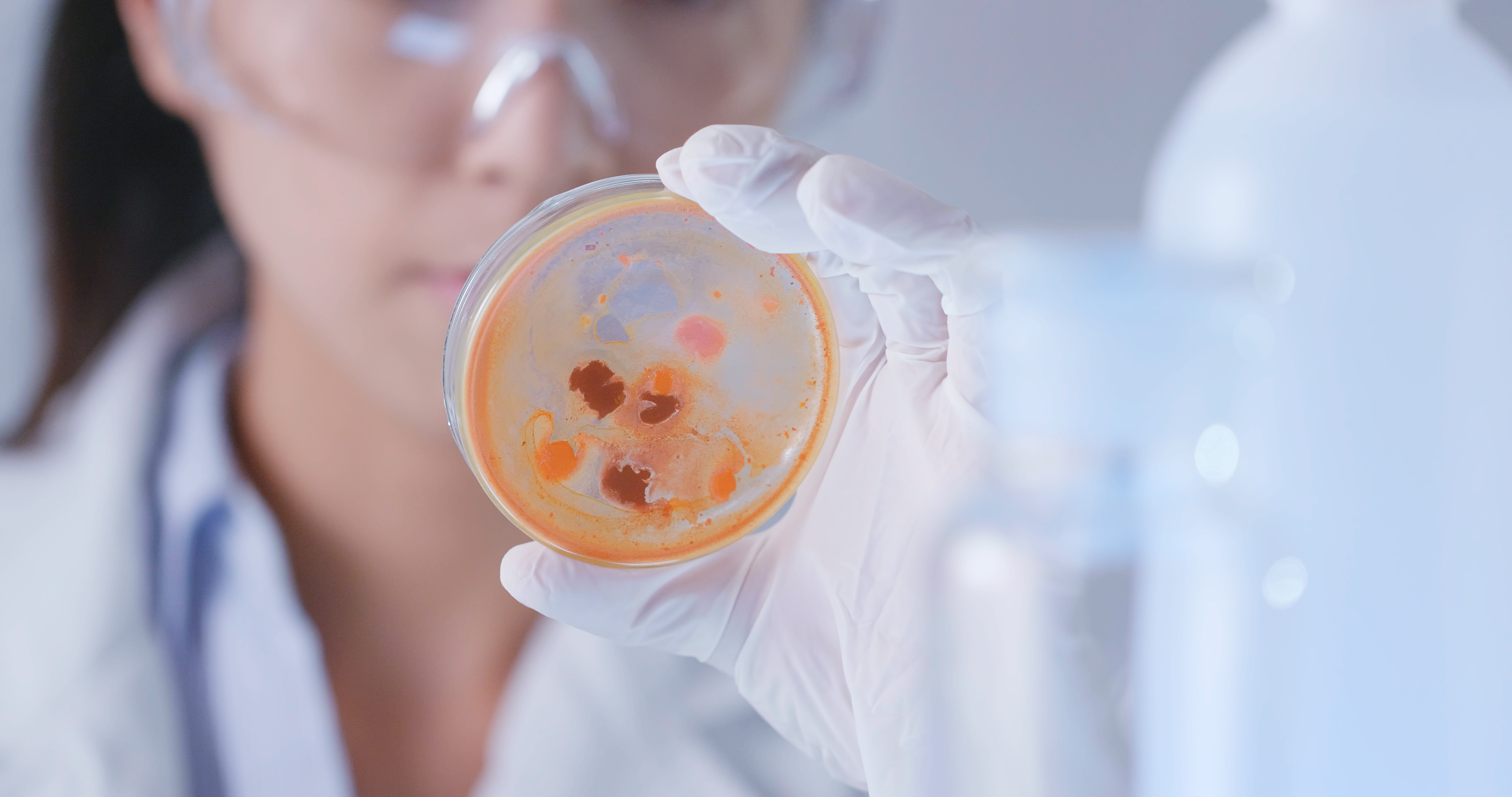 Criptococose: como a ciência testa Cannabis no tratamento de infecções fúngicas