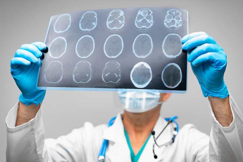 disturbios neurologicos tipos