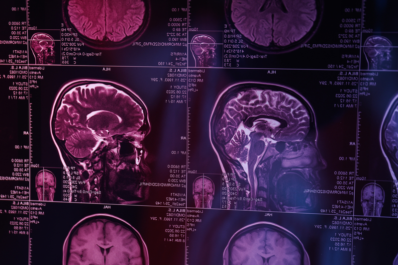 sintomas dosdisturbios neurologicos