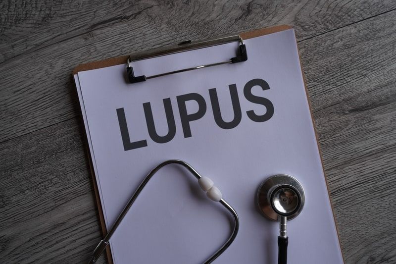 lupus-eritematoso-sistemico